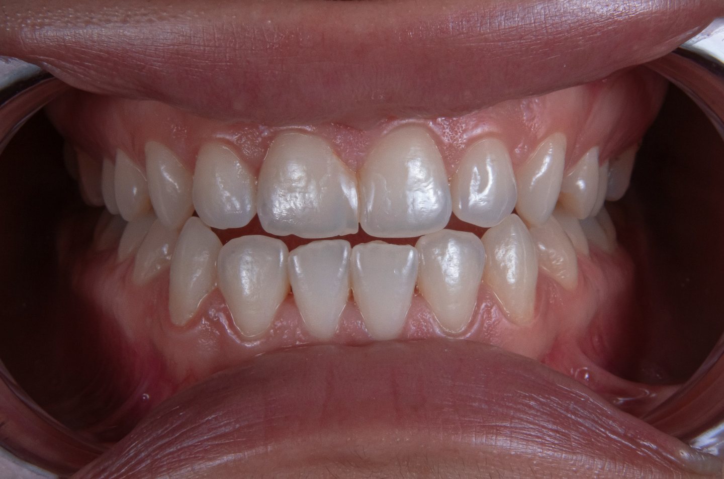 Before Image