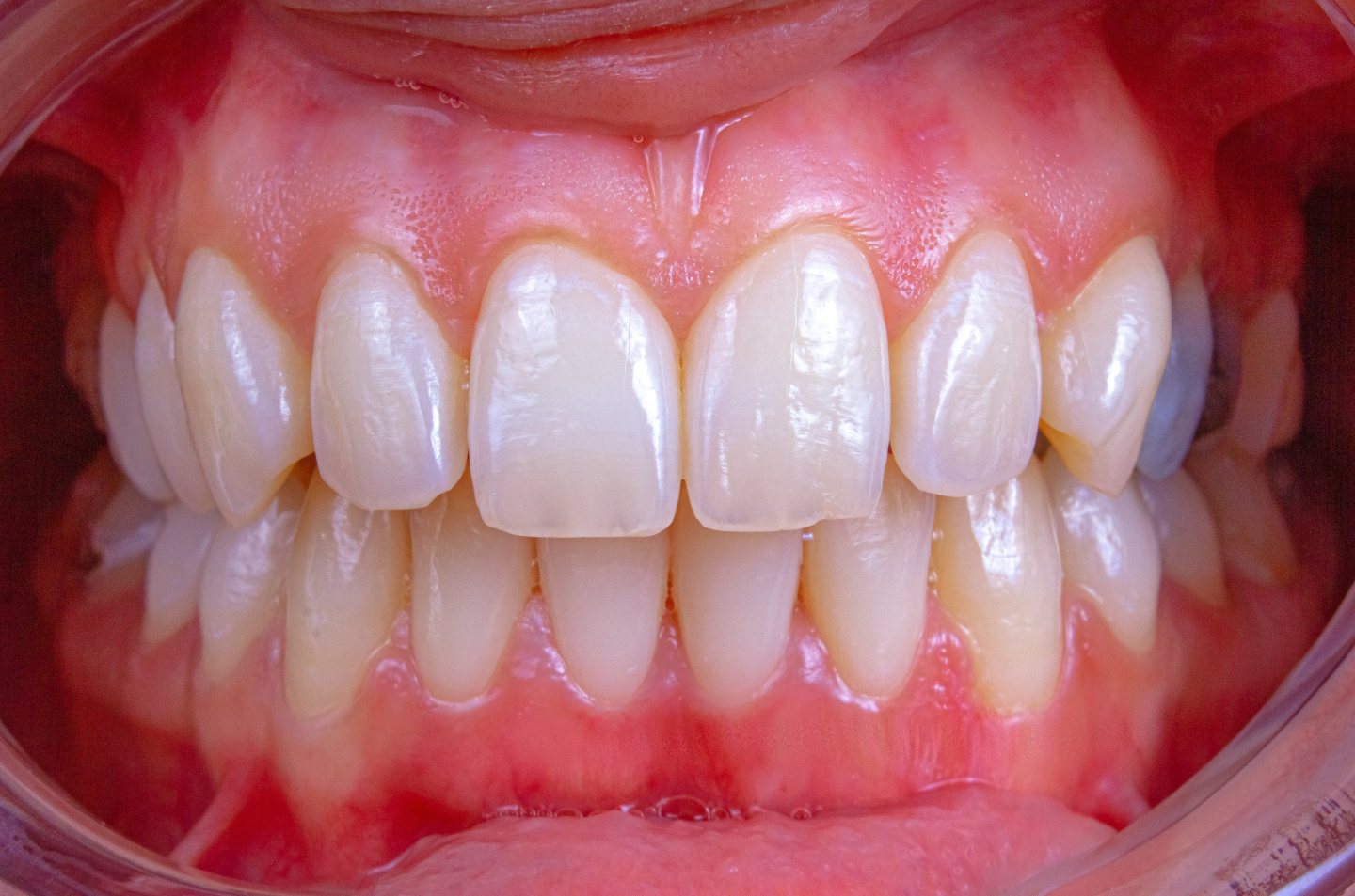 Before_image