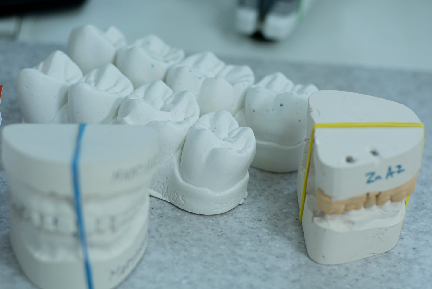 Teeth Whitening: At-Home vs. In-Clinic—What’s Better?
